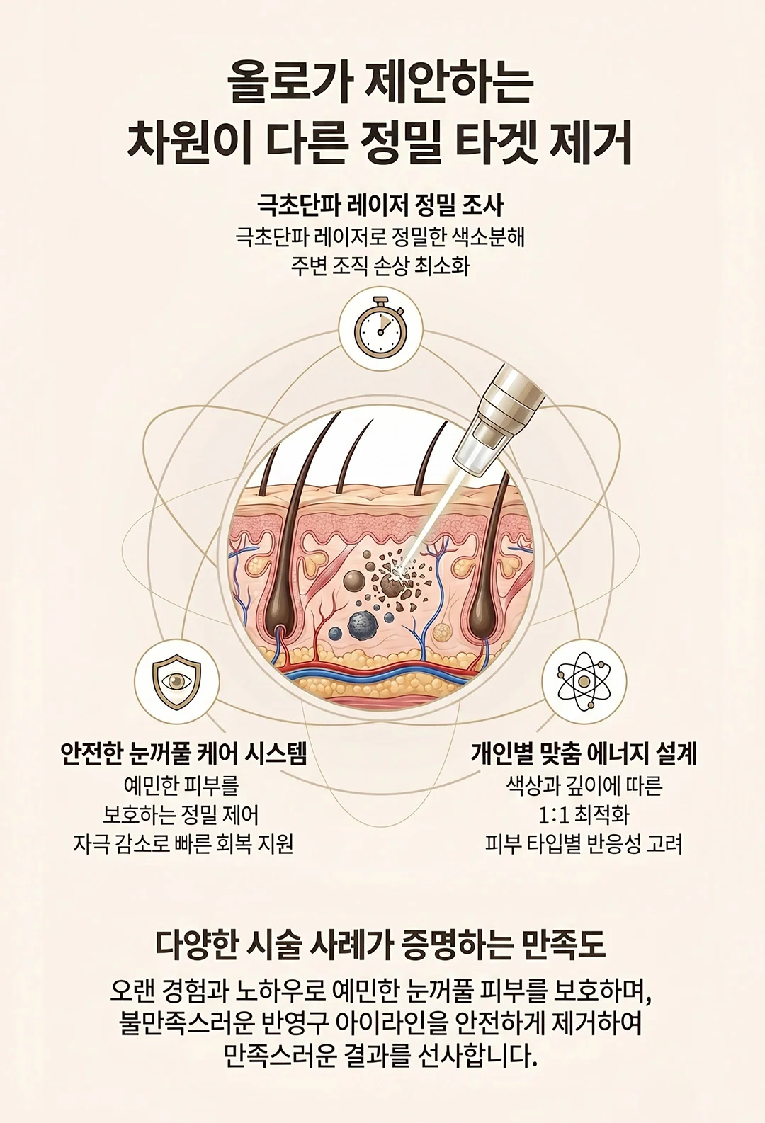 올로성형외과 아이라인 정밀 타겟 제거